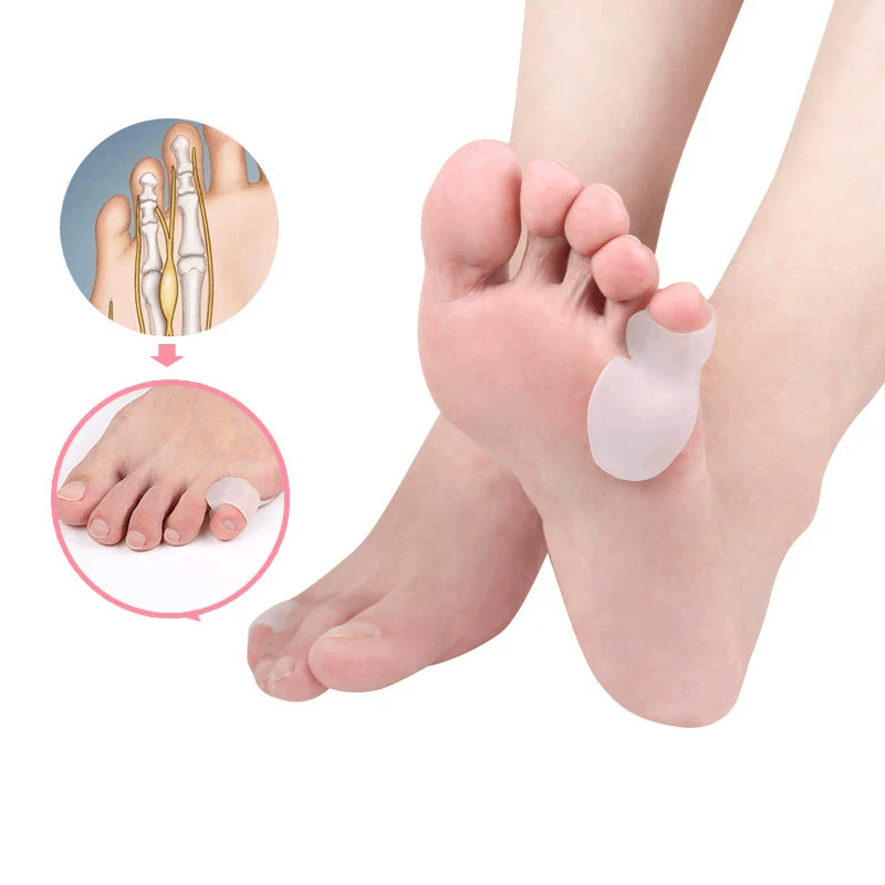 Correcteur d'oignon de protect - Toe Separator Silicon avis et prix