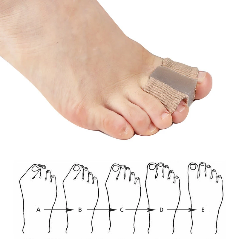 Séparateurs d'orteils en Gel a - Toe Separator Silicon avis et prix